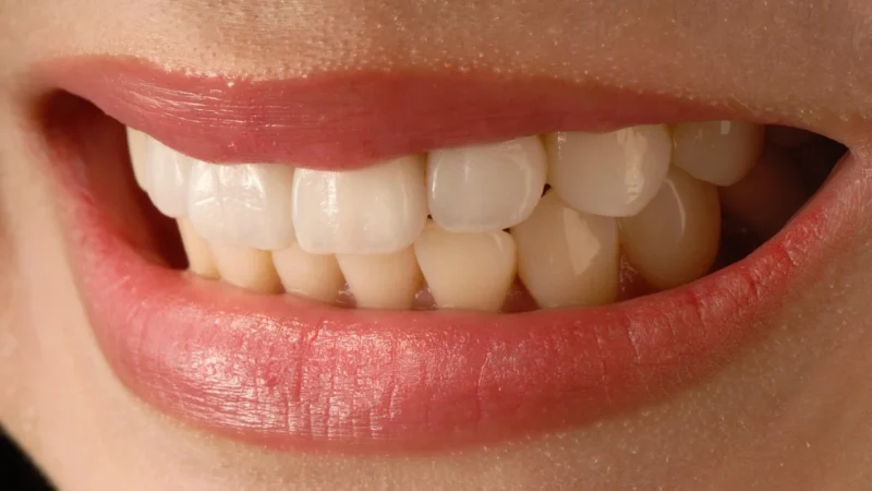 Gc G-Cem Veneer Uzupełnienie 1Ml