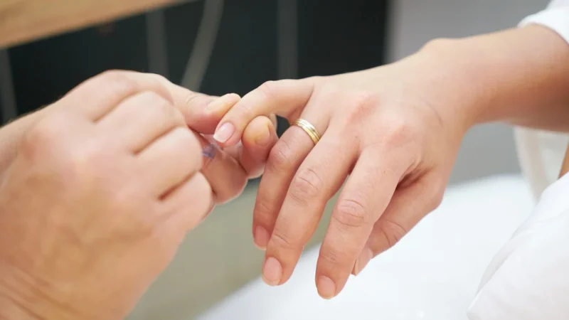 Gc Mi Varnish 1 X 0,5Ml Mięta