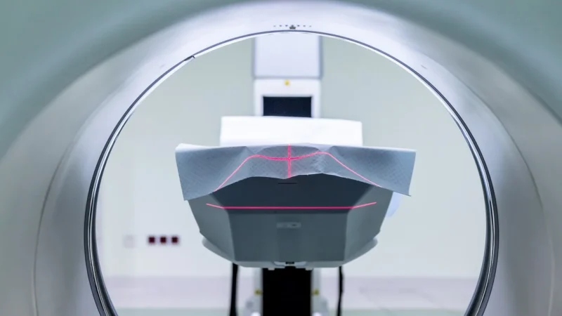 Nowoczesne technologie obrazowania MRI w medycynie