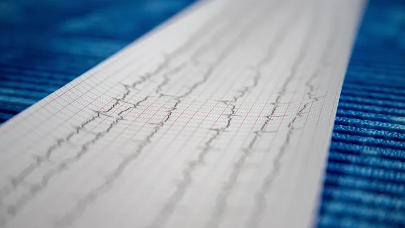 Stetoskop Kardiologiczny Mdf Z Tytanu Procardial 797T C34