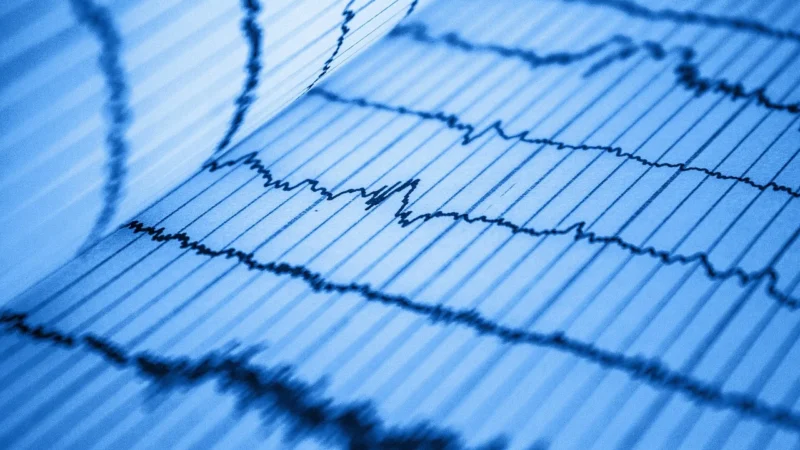 Szkolenie z interpretacji EKG: Jak rozpoznawać arytmie serca