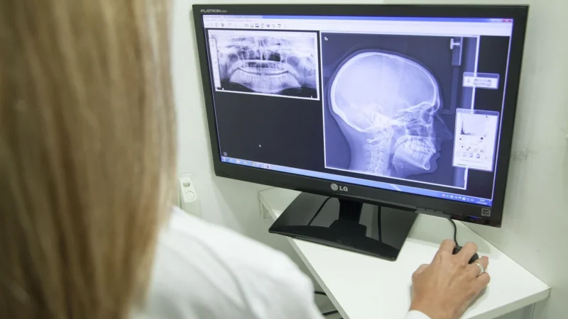 Ultra-Viol Negatoskop wysokiej częstotliwości NGP-30 hf, 3 -klatkowy, bez regulacji