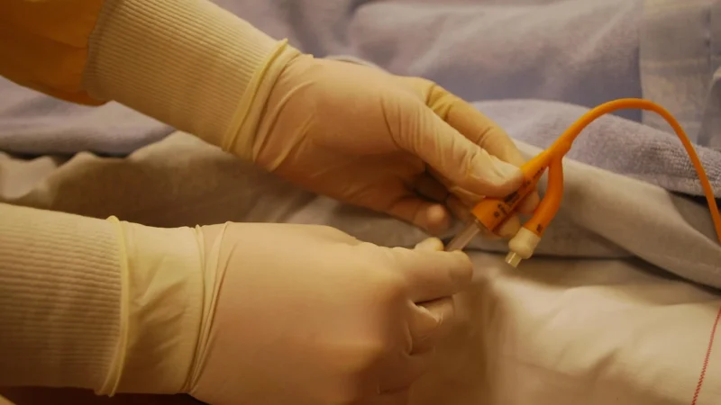 Zarys Cewnik Urologiczny Foleya Dwudrożny Lateksowy Ch 14 1 Szt